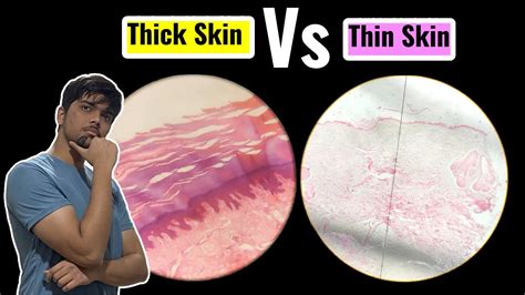 thick skinned vs thin